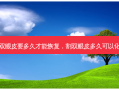 割双眼皮要多久才能恢复，割双眼皮多久可以化妆
