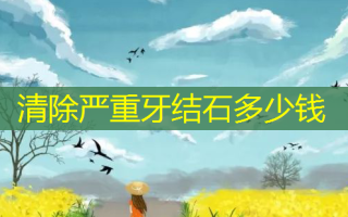 清除严重牙结石多少钱