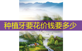种植牙要花价钱要多少