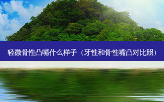 轻微骨性凸嘴什么样子（牙性和骨性嘴凸对比照）