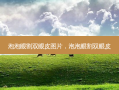 泡泡眼割双眼皮图片，泡泡眼割双眼皮