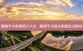 眼睛手术疤痕图片大全，眼部手术缝合疤痕能去除吗