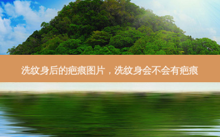 洗纹身后的疤痕图片，洗纹身会不会有疤痕