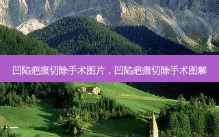 凹陷疤痕切除手术图片，凹陷疤痕切除手术图解