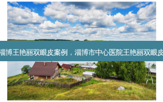 淄博王艳丽双眼皮案例，淄博市中心医院王艳丽双眼皮