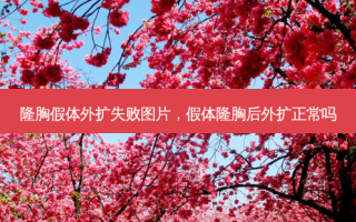 隆胸假体外扩失败图片，假体隆胸后外扩正常吗