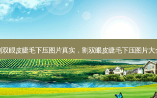 割双眼皮睫毛下压图片真实，割双眼皮睫毛下压图片大全