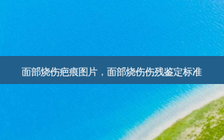 面部烧伤疤痕图片，面部烧伤伤残鉴定标准