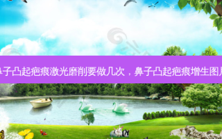 鼻子凸起疤痕激光磨削要做几次，鼻子凸起疤痕增生图片