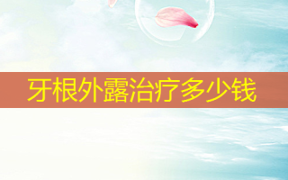 牙根外露多少钱