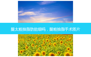 腿太粗抽脂肪能细吗，腿粗抽脂手术图片