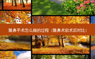 隆鼻手术怎么做的过程（隆鼻术前术后对比）