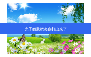 光子嫩肤把炎症打出来了