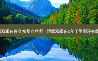 埋线双眼皮多久恢复自然呢（埋线双眼皮6年了里面还有线么）