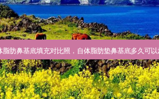 自体脂肪鼻基底填充对比照，自体脂肪垫鼻基底多久可以消肿