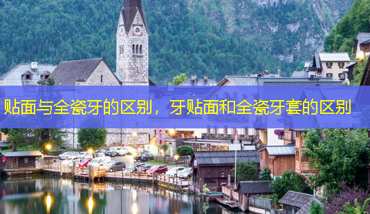 贴面与全瓷牙的区别,牙贴面和全瓷牙套的区别-第1张图片-美呗严选网 贴面与全瓷牙的区别,牙贴面和全瓷牙套的区别-第1张图片-美呗严选网