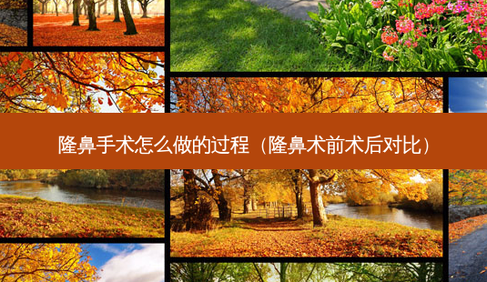 隆鼻手术怎么做的过程(隆鼻术前术后对比)-第1张图片-美呗严选网 隆鼻手术怎么做的过程(隆鼻术前术后对比)-第1张图片-美呗严选网