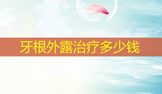 牙根外露多少钱-第1张图片-美呗严选网 牙根外露多少钱-第1张图片-美呗严选网