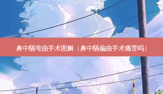 鼻中隔弯曲手术图解(鼻中隔偏曲手术痛苦吗)-第1张图片-美呗严选网 鼻中隔弯曲手术图解(鼻中隔偏曲手术痛苦吗)-第1张图片-美呗严选网