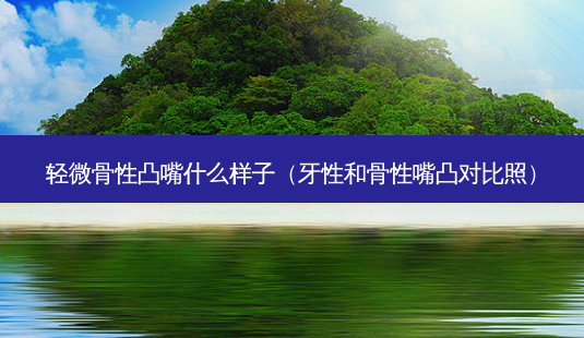 轻微骨性凸嘴什么样子(牙性和骨性嘴凸对比照)-第1张图片-美呗严选网 轻微骨性凸嘴什么样子(牙性和骨性嘴凸对比照)-第1张图片-美呗严选网