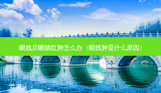 眼线后眼睛红肿怎么办(眼线肿是什么原因)-第1张图片-美呗严选网 眼线后眼睛红肿怎么办(眼线肿是什么原因)-第1张图片-美呗严选网