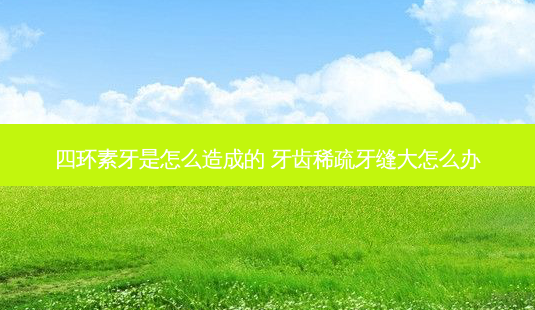 四环素牙是怎么造成的 牙齿稀疏牙缝大怎么办-第1张图片-美呗严选网 四环素牙是怎么造成的 牙齿稀疏牙缝大怎么办-第1张图片-美呗严选网