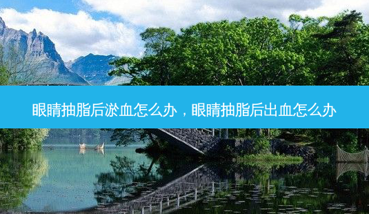 眼睛抽脂后淤血怎么办,眼睛抽脂后出血怎么办-第1张图片-美呗严选网 眼睛抽脂后淤血怎么办,眼睛抽脂后出血怎么办-第1张图片-美呗严选网