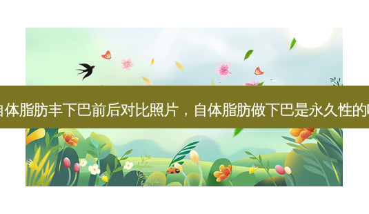 自体脂肪丰下巴前后对比照片,自体脂肪做下巴是永久性的吗-第1张图片-美呗严选网 自体脂肪丰下巴前后对比照片,自体脂肪做下巴是永久性的吗-第1张图片-美呗严选网