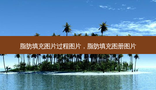 脂肪填充图片过程图片,脂肪填充图册图片-第1张图片-美呗严选网 脂肪填充图片过程图片,脂肪填充图册图片-第1张图片-美呗严选网