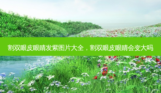 割双眼皮眼睛发紫图片大全,割双眼皮眼睛会变大吗-第1张图片-美呗严选网 割双眼皮眼睛发紫图片大全,割双眼皮眼睛会变大吗-第1张图片-美呗严选网