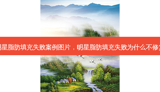 明星脂肪填充失败案例图片,明星脂肪填充失败为什么不修复-第1张图片-美呗严选网 明星脂肪填充失败案例图片,明星脂肪填充失败为什么不修复-第1张图片-美呗严选网
