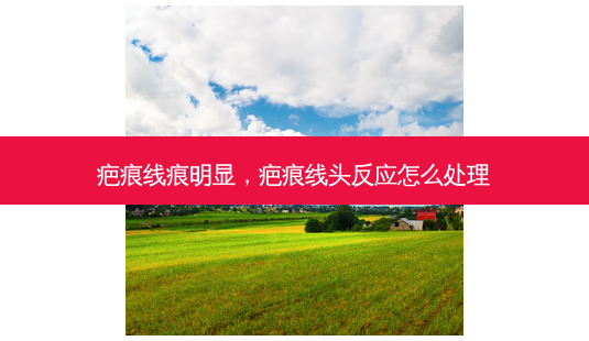 疤痕线痕明显,疤痕线头反应怎么处理-第1张图片-美呗严选网 疤痕线痕明显,疤痕线头反应怎么处理-第1张图片-美呗严选网