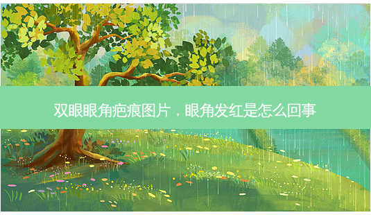 双眼眼角疤痕图片,眼角发红是怎么回事-第1张图片-美呗严选网 双眼眼角疤痕图片,眼角发红是怎么回事-第1张图片-美呗严选网