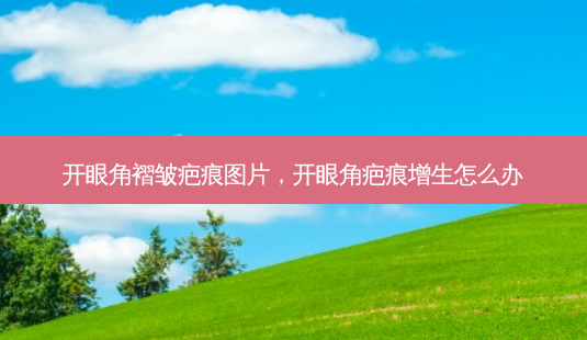 开眼角褶皱疤痕图片,开眼角疤痕增生怎么办-第1张图片-美呗严选网 开眼角褶皱疤痕图片,开眼角疤痕增生怎么办-第1张图片-美呗严选网