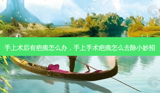 手上术后有疤痕怎么办,手上手术疤痕怎么去除小妙招-第1张图片-美呗严选网 手上术后有疤痕怎么办,手上手术疤痕怎么去除小妙招-第1张图片-美呗严选网