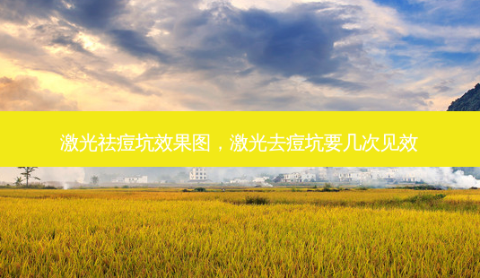 激光祛痘坑效果图,激光去痘坑要几次见效-第1张图片-美呗严选网 激光祛痘坑效果图,激光去痘坑要几次见效-第1张图片-美呗严选网