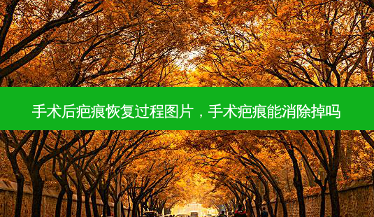 手术后疤痕恢复过程图片,手术疤痕能消除掉吗-第1张图片-美呗严选网 手术后疤痕恢复过程图片,手术疤痕能消除掉吗-第1张图片-美呗严选网