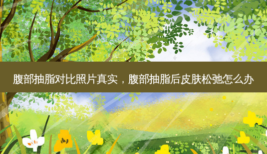 腹部抽脂对比照片真实,腹部抽脂后皮肤松弛怎么办-第1张图片-美呗严选网 腹部抽脂对比照片真实,腹部抽脂后皮肤松弛怎么办-第1张图片-美呗严选网