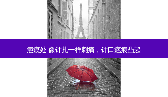 疤痕处 像针扎一样刺痛,针口疤痕凸起-第1张图片-美呗严选网 疤痕处 像针扎一样刺痛,针口疤痕凸起-第1张图片-美呗严选网