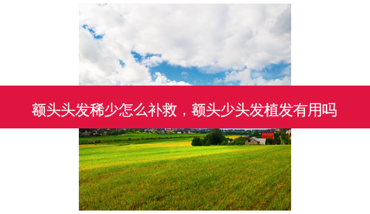 额头头发稀少怎么补救,额头少头发植发有用吗-第1张图片-美呗严选网 额头头发稀少怎么补救,额头少头发植发有用吗-第1张图片-美呗严选网