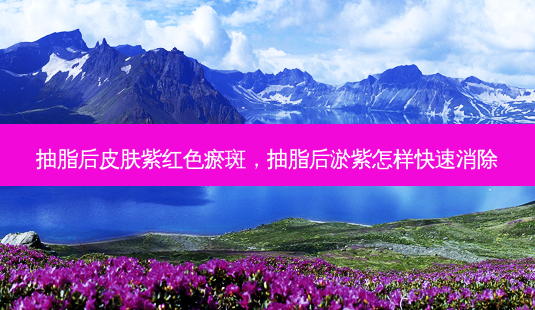 抽脂后皮肤紫红色瘀斑,抽脂后淤紫怎样快速消除-第1张图片-美呗严选网 抽脂后皮肤紫红色瘀斑,抽脂后淤紫怎样快速消除-第1张图片-美呗严选网