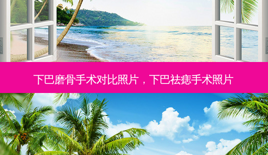 下巴磨骨手术对比照片,下巴祛痣手术照片-第1张图片-美呗严选网 下巴磨骨手术对比照片,下巴祛痣手术照片-第1张图片-美呗严选网