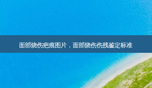 面部烧伤疤痕图片,面部烧伤伤残鉴定标准-第1张图片-美呗严选网 面部烧伤疤痕图片,面部烧伤伤残鉴定标准-第1张图片-美呗严选网