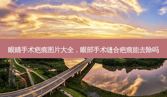 眼睛手术疤痕图片大全,眼部手术缝合疤痕能去除吗-第1张图片-美呗严选网 眼睛手术疤痕图片大全,眼部手术缝合疤痕能去除吗-第1张图片-美呗严选网