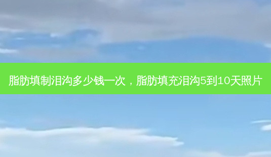脂肪填制泪沟多少钱一次,脂肪填充泪沟5到10天照片-第1张图片-美呗严选网 脂肪填制泪沟多少钱一次,脂肪填充泪沟5到10天照片-第1张图片-美呗严选网
