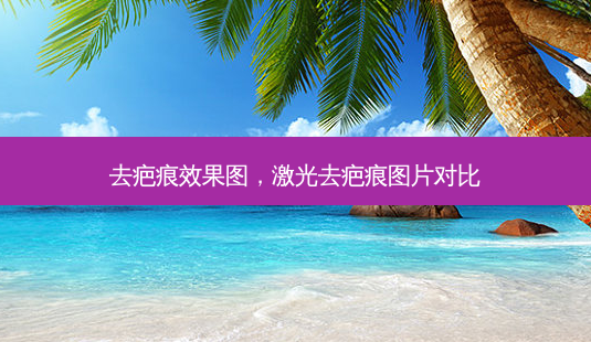 去疤痕效果图,激光去疤痕图片对比-第1张图片-美呗严选网 去疤痕效果图,激光去疤痕图片对比-第1张图片-美呗严选网