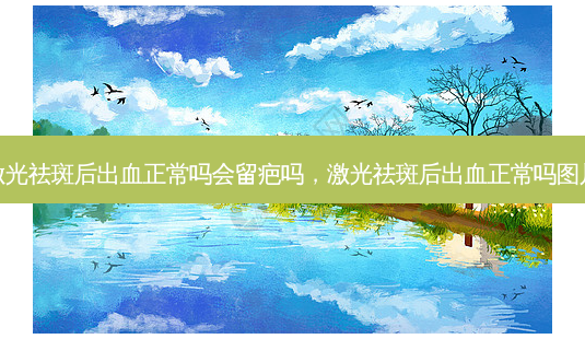激光祛斑后出血正常吗会留疤吗，激光祛斑后出血正常吗图片-第1张图片-美呗严选网
