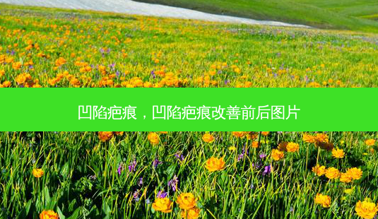 凹陷疤痕,凹陷疤痕改善前后图片-第1张图片-美呗严选网 凹陷疤痕,凹陷疤痕改善前后图片-第1张图片-美呗严选网