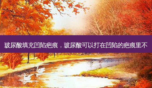 玻尿酸填充凹陷疤痕,玻尿酸可以打在凹陷的疤痕里不-第1张图片-美呗严选网 玻尿酸填充凹陷疤痕,玻尿酸可以打在凹陷的疤痕里不-第1张图片-美呗严选网