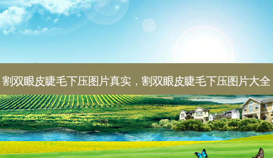 割双眼皮睫毛下压图片真实,割双眼皮睫毛下压图片大全-第1张图片-美呗严选网 割双眼皮睫毛下压图片真实,割双眼皮睫毛下压图片大全-第1张图片-美呗严选网